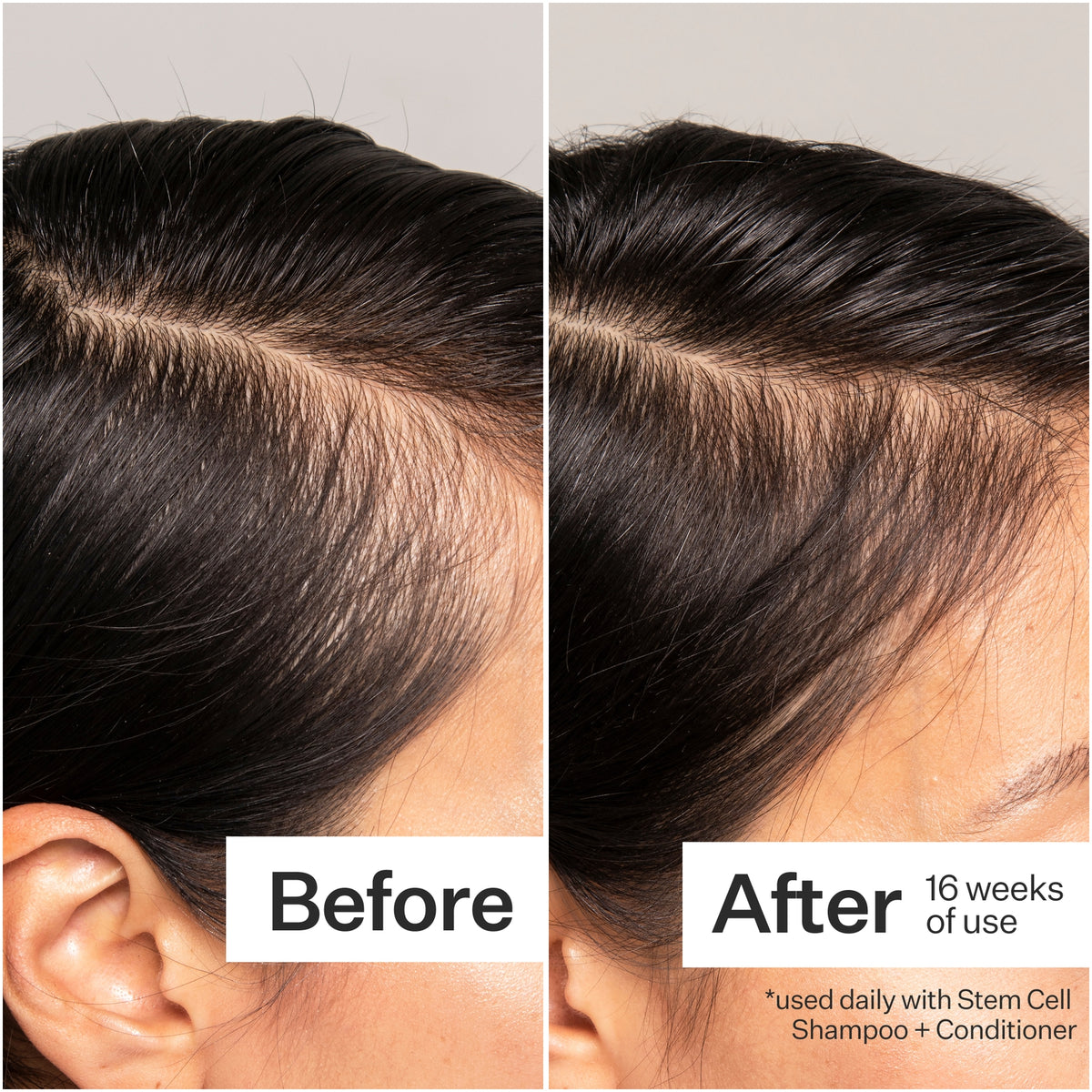 Act+Acre Cold Processed® 3% Stem Cell Peptide Treatment – 3 oz